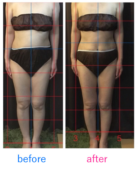 内臓美体質改善ダイエット体験例